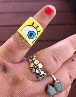 Everyone knows boo-boos heal faster with cute band-aids. Thanks, Graydon! 